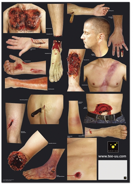 Verletzungsmuster-Set für Crash & Carry Puppe